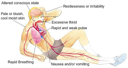 Red Cross Apply First Aid Demo Red Cross Training Services Online Training